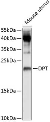 Western Blot: Dermatopontin AntibodyBSA Free [NBP2-92566]